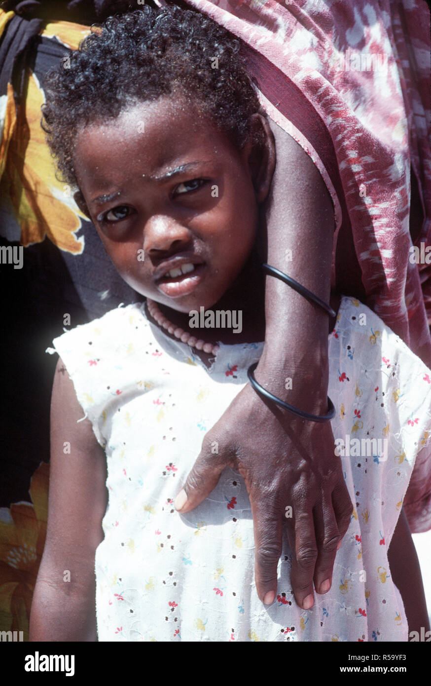 1993 - un somalo bambina guarda verso la fotocamera mentre si è in attesa di essere esaminato da un Navy corpsman. La lotta contro il supporto di servizio il distacco 15 (CSSD-15) sta conducendo un medico civica programma di azione per le strade della città durante la multinazionale soccorsi Restore Hope. Foto Stock