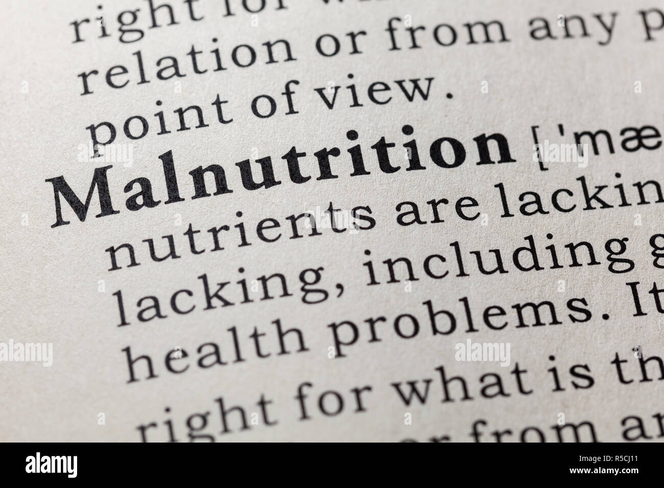 Fake Dizionario, definizione del dizionario della parola malnutrizione. comprendente i principali parole descrittive. Foto Stock