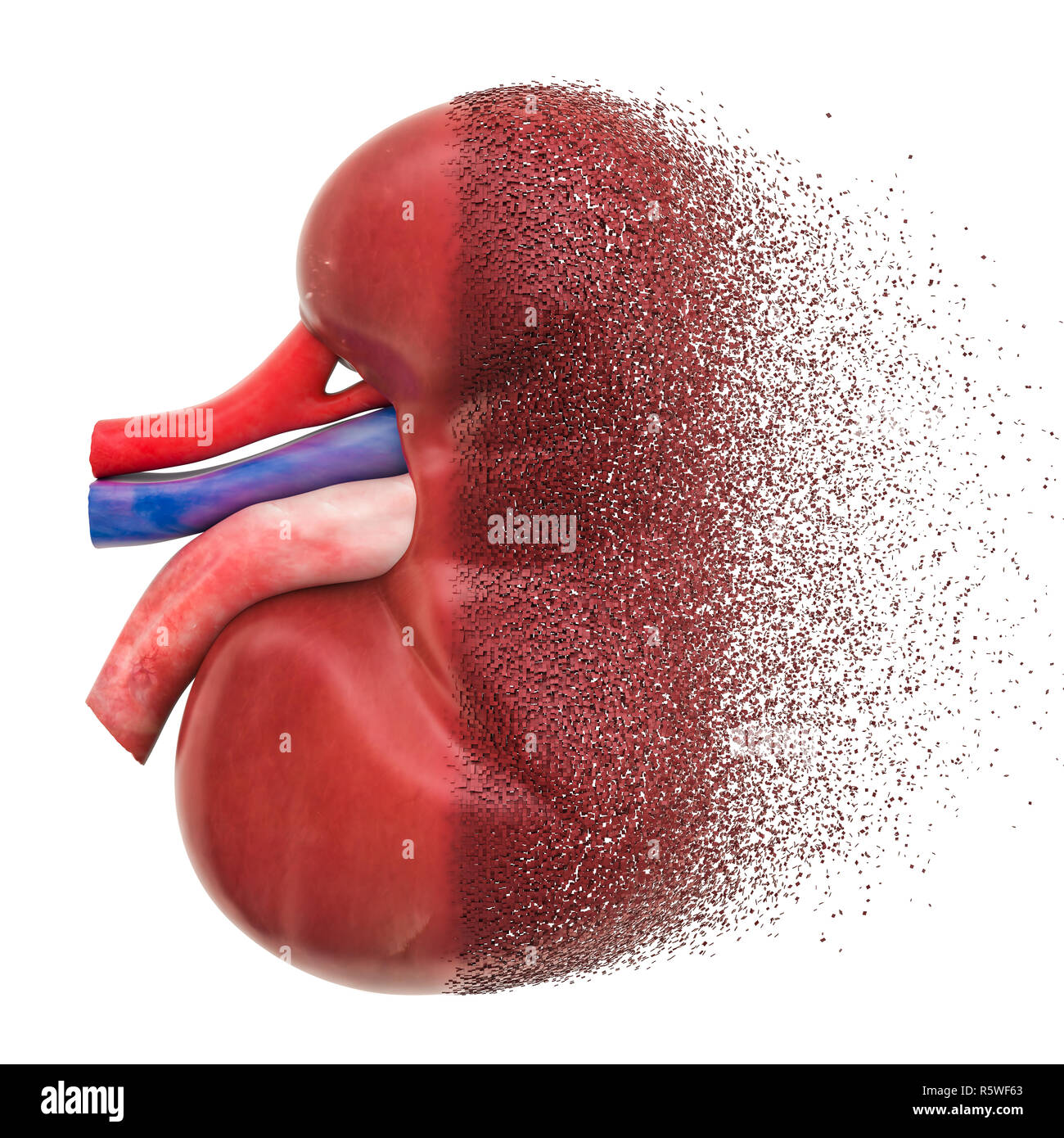 Insufficienza renale cronica, insufficienza renale concetto. 3D rendering isolati su sfondo bianco Foto Stock