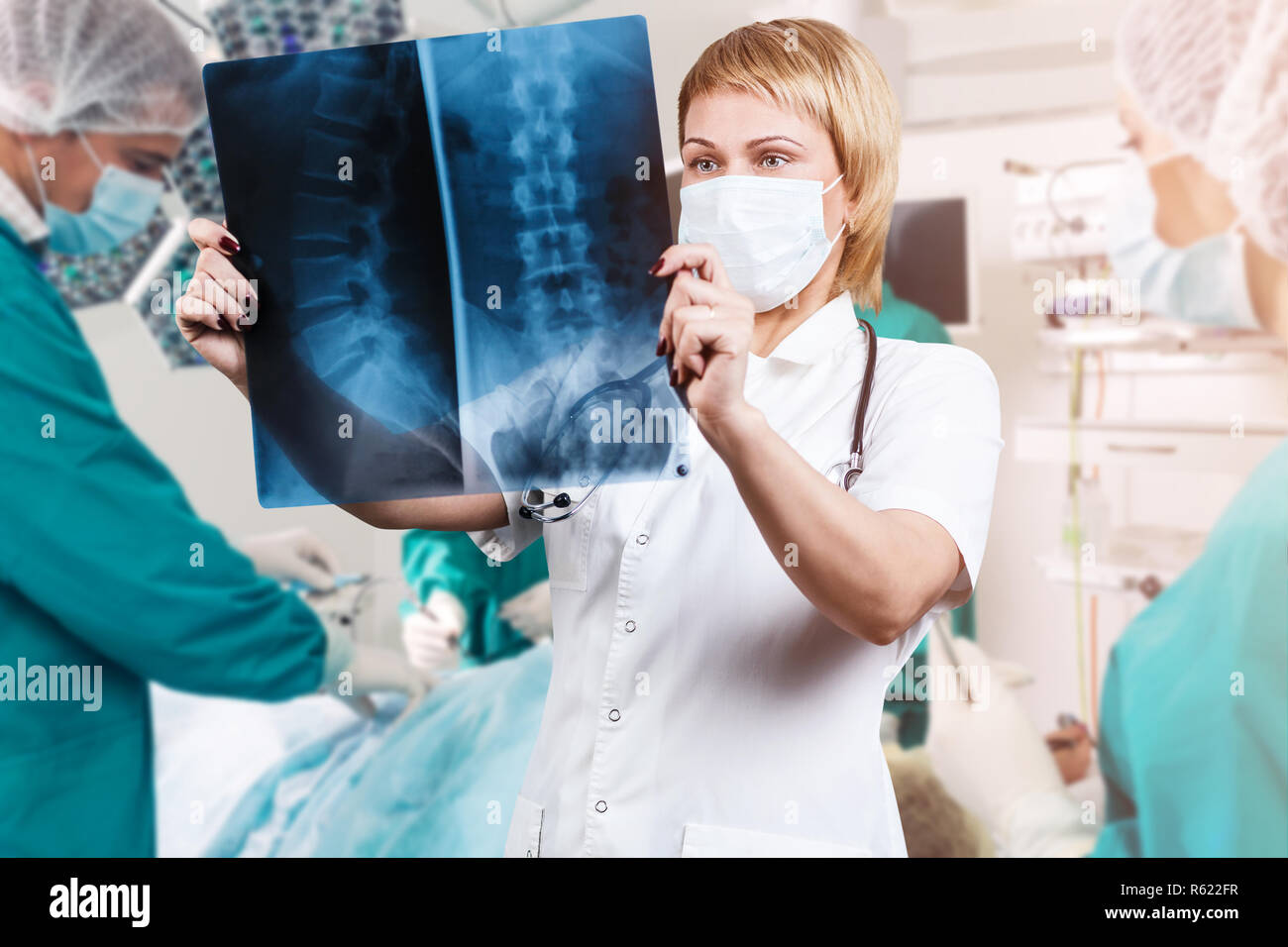 Medico donna guardando un x-ray della colonna vertebrale. Foto Stock