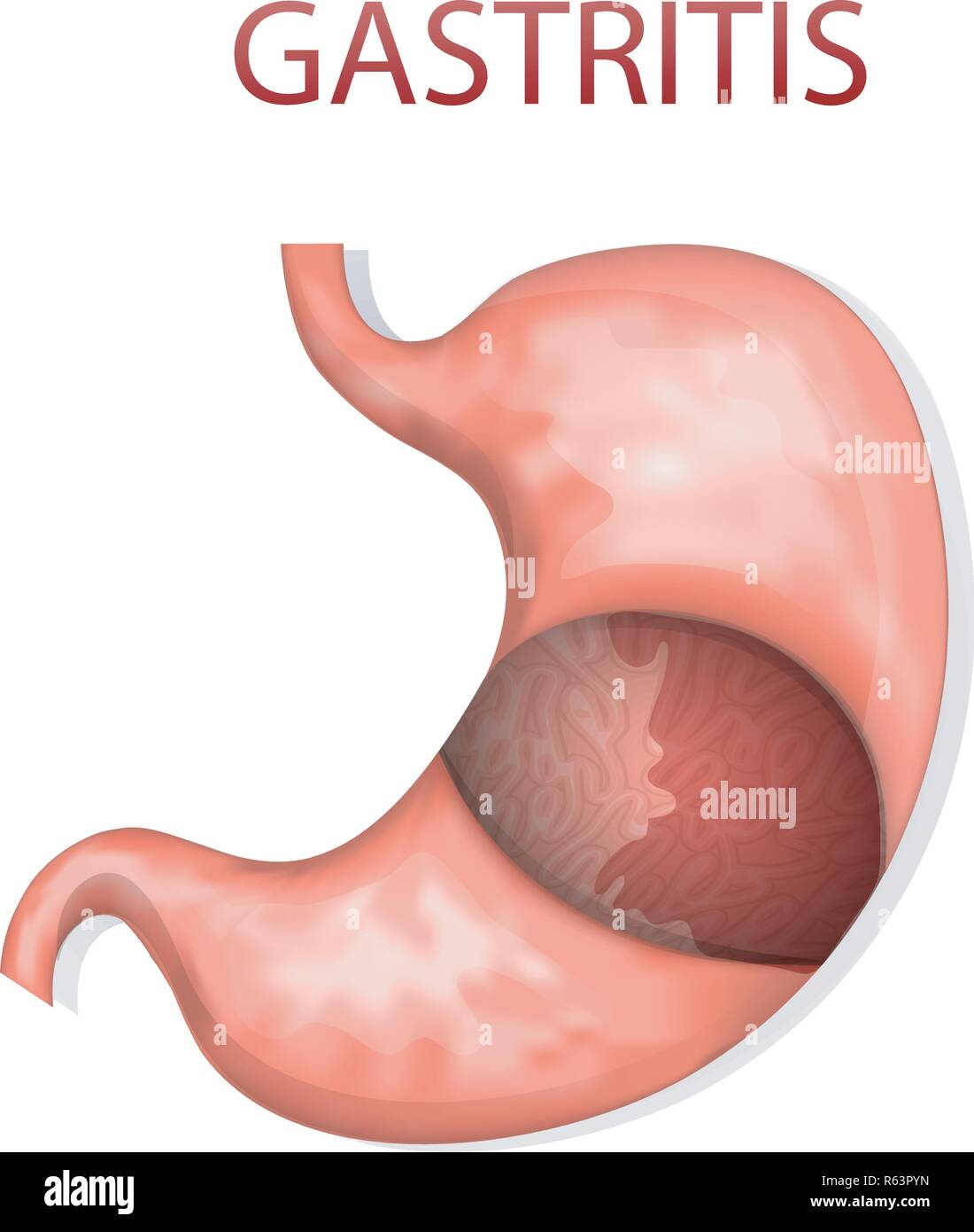 Illustrazioni di stomaco, gastrite. gastroenterology. gaster Illustrazione Vettoriale