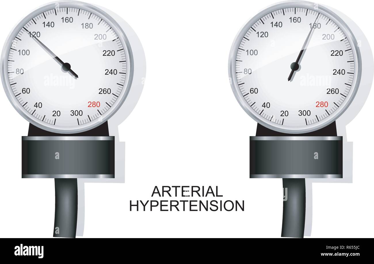 Illustrazione del quadrante del tonometro e a pressione normale e ipertensione Illustrazione Vettoriale