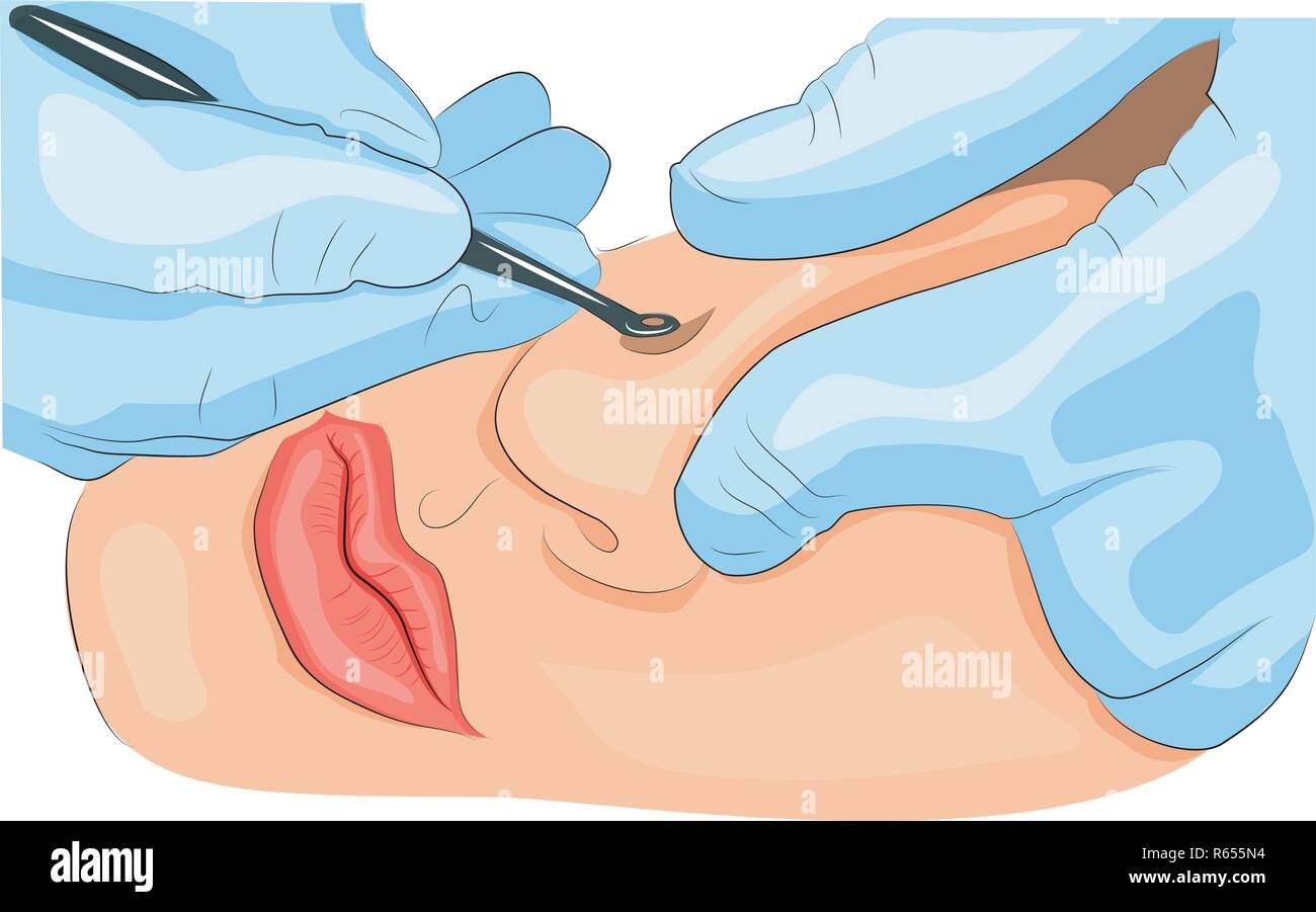 Illustrazione della pulizia meccanica del volto Illustrazione Vettoriale