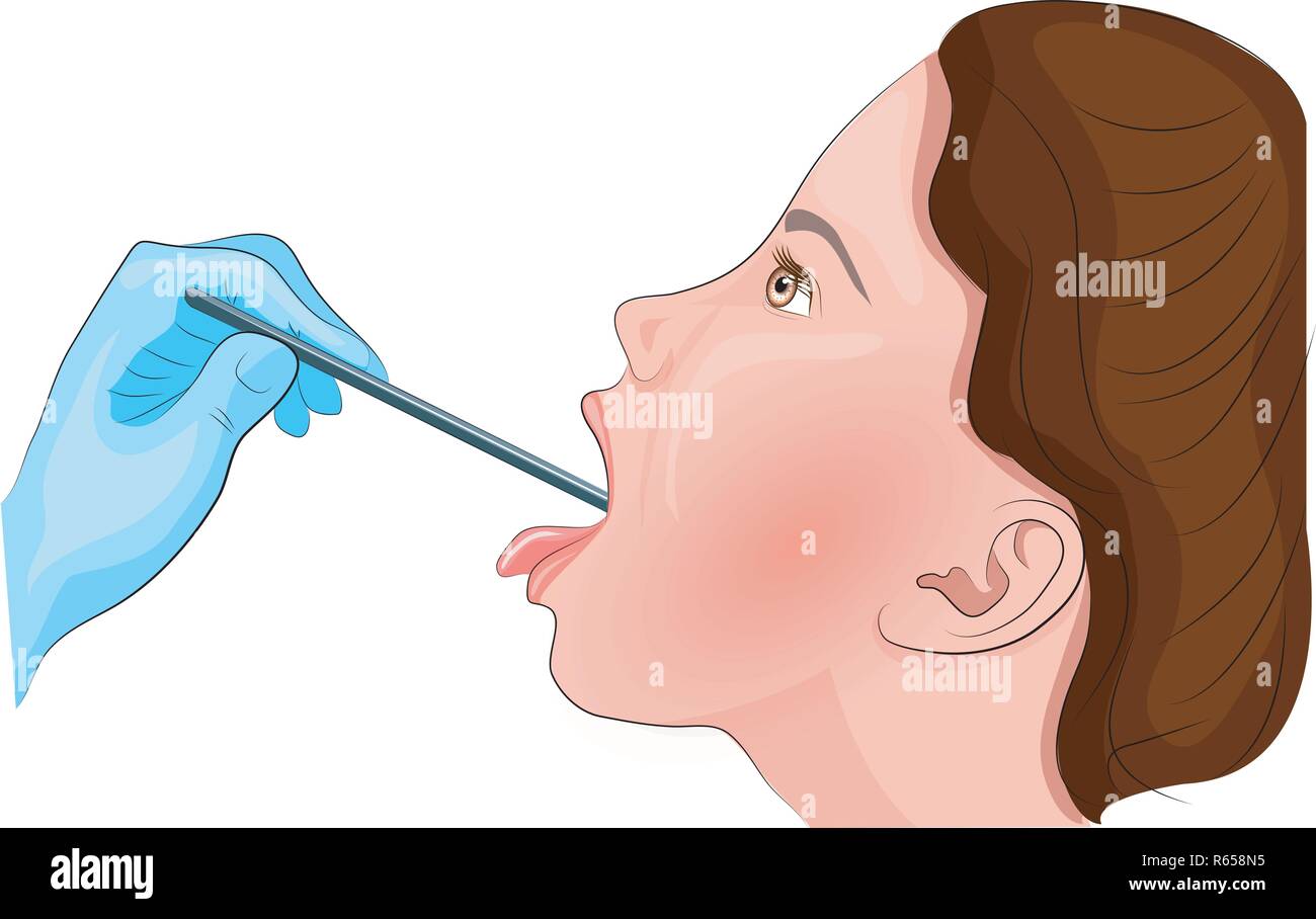 Illustrazione del mal di gola. Ispezione della gola. angina Illustrazione Vettoriale