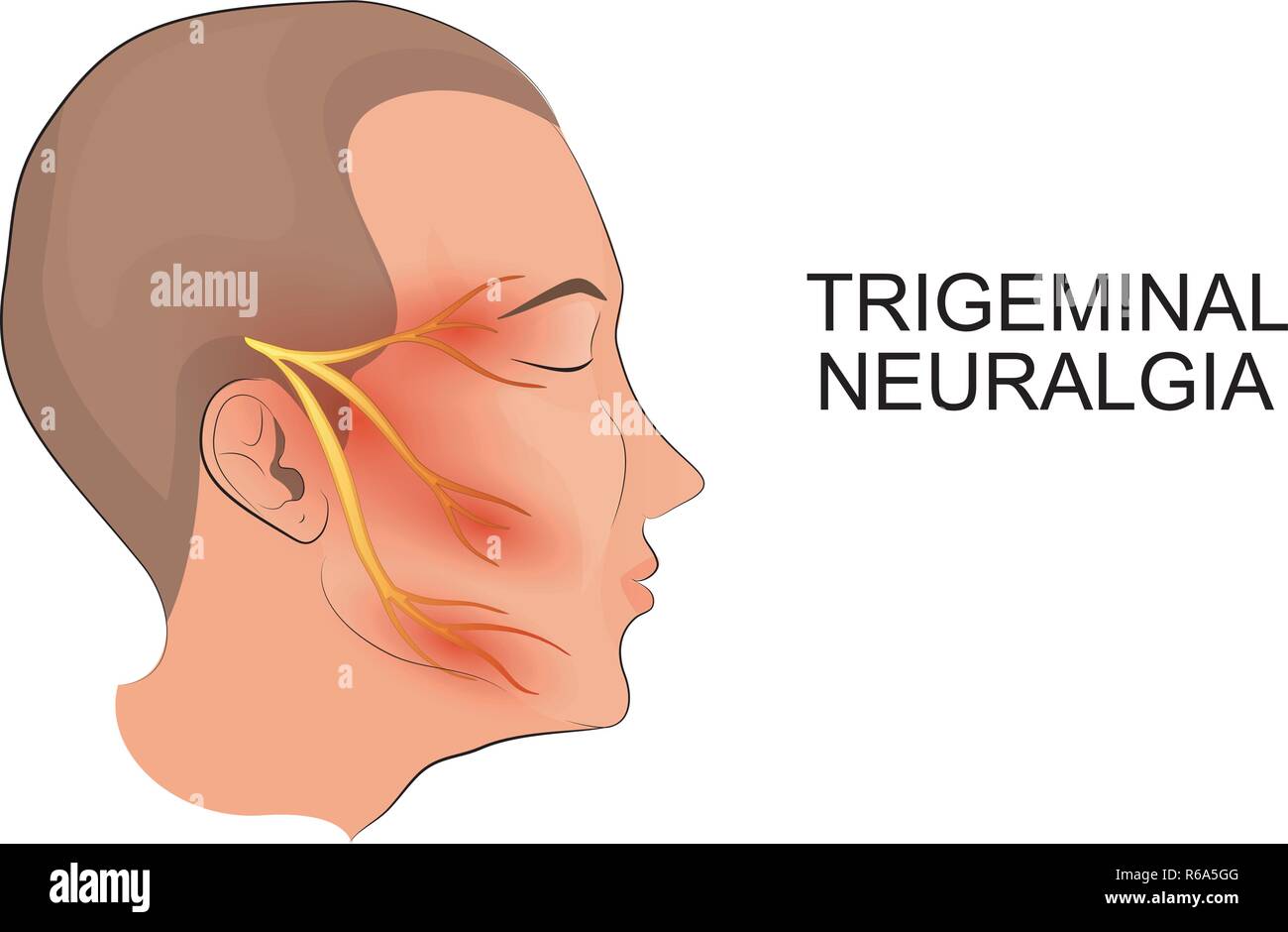 Illustrazione di una testa maschio. la nevralgia del trigemino. neuroscienze Illustrazione Vettoriale