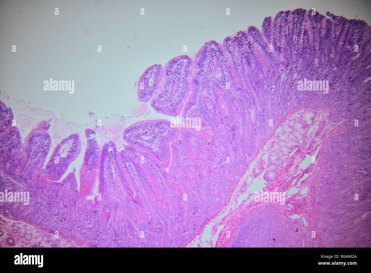 Umano parete intestinale sotto microscopio Foto Stock