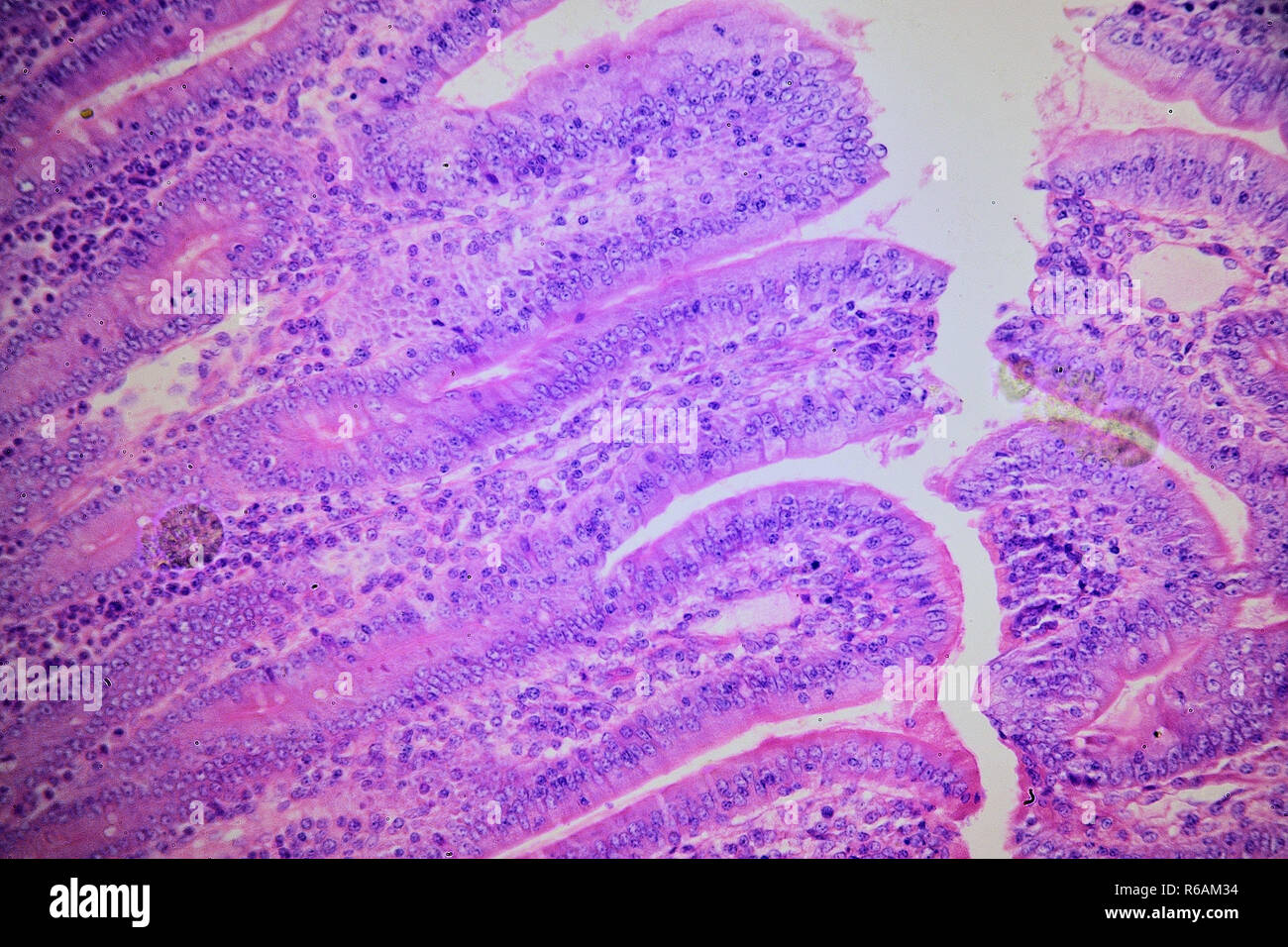 Umano parete intestinale sotto microscopio Foto Stock
