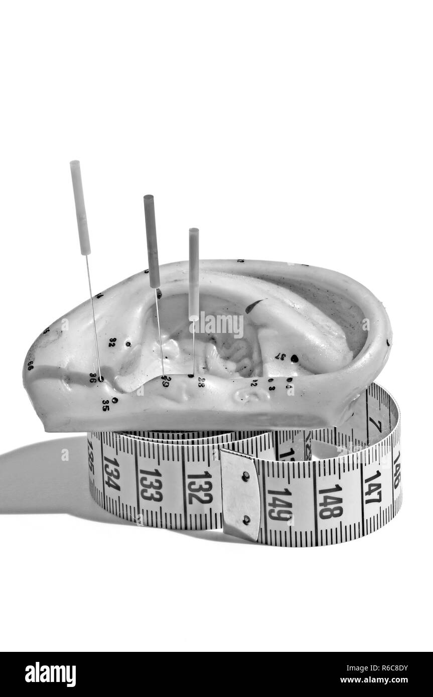 Aghi di agopuntura Foto Stock