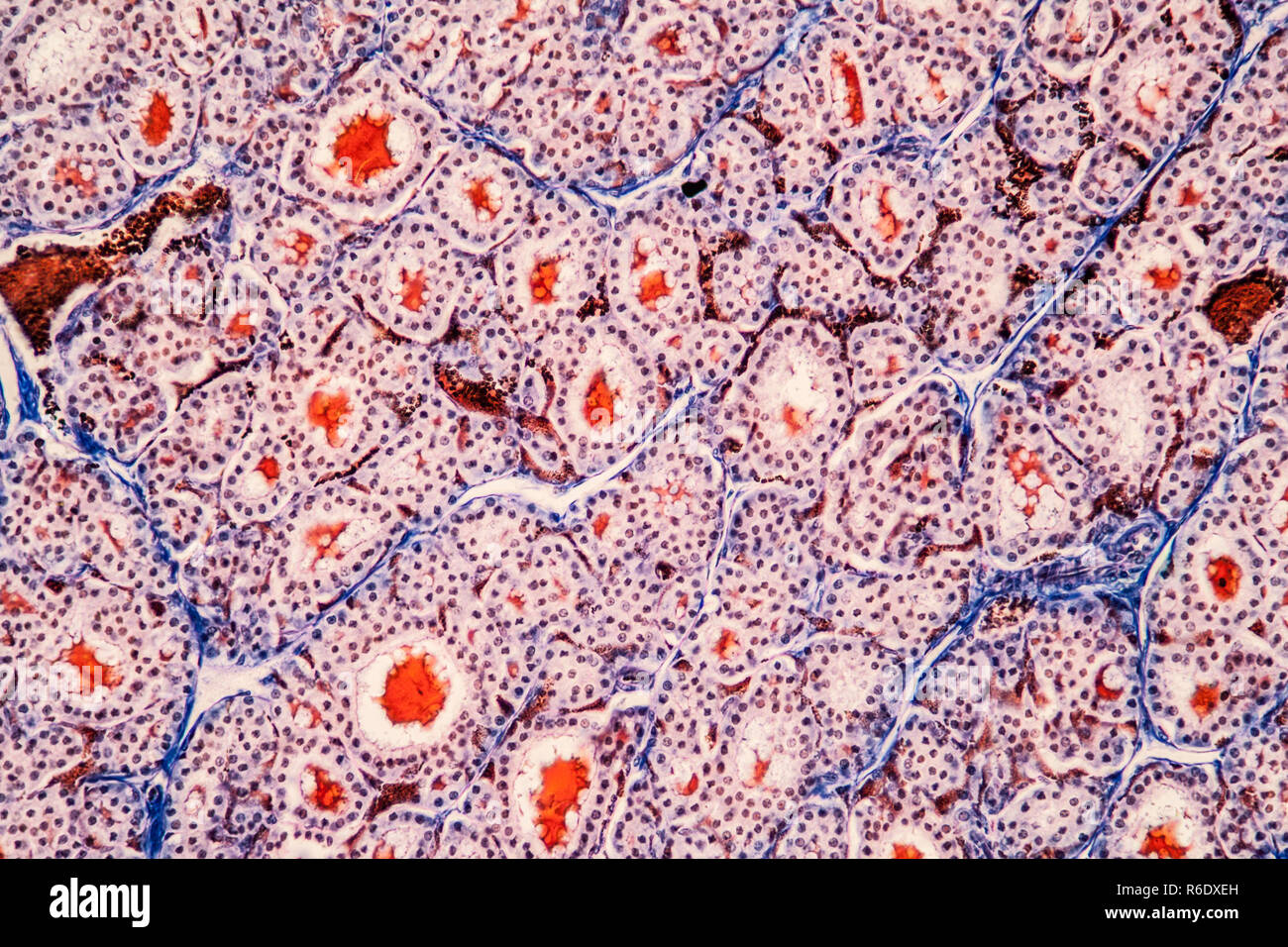 Il tessuto tiroide sotto il microscopio 200x Foto Stock