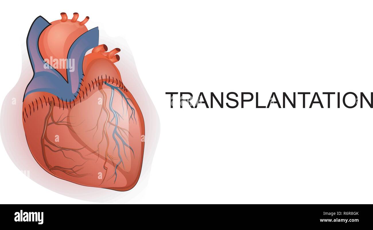 Illustrazione del trapianto di organo. Illustrazione Vettoriale