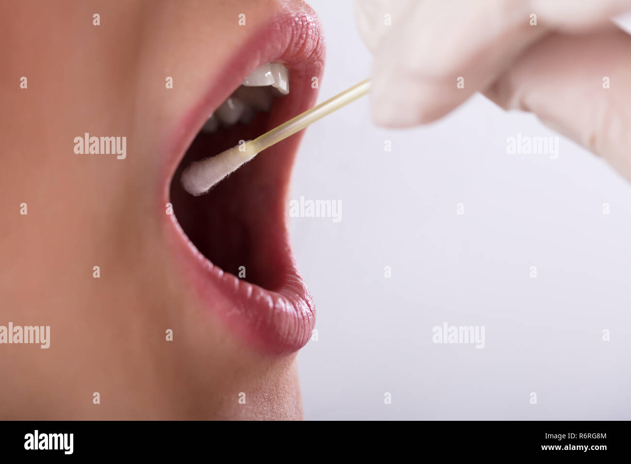 Dentista tenendo saliva di prova di un paziente Foto Stock