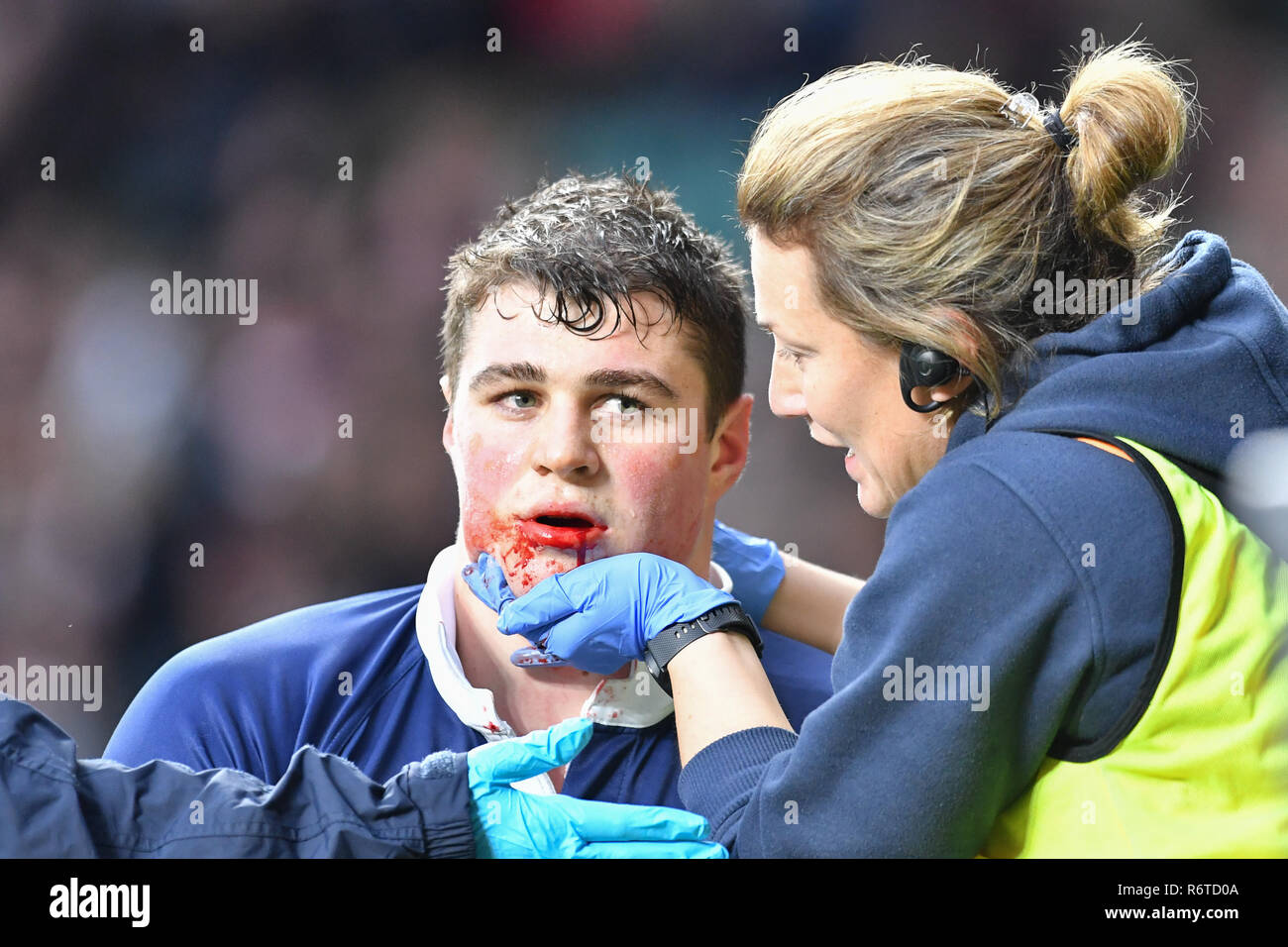 Londra, Regno Unito. 06 Dic, 2018. Sven Kerneis della Oxford University è stato ferito durante la Gamma Match 2018 tra Ourfc v Curufc a Twickenham Stadium di giovedì, 06 dicembre 2018. Londra Inghilterra. (Solo uso editoriale, è richiesta una licenza per uso commerciale. Nessun uso in scommesse, giochi o un singolo giocatore/club/league pubblicazioni.) Credito: Taka G Wu/Alamy News Credito: Taka Wu/Alamy Live News Foto Stock