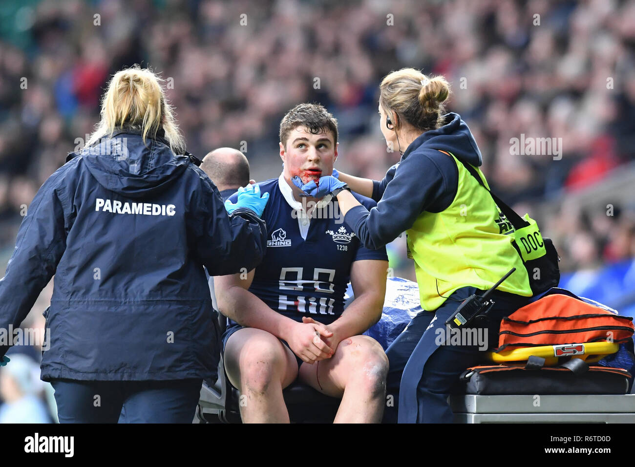 Londra, Regno Unito. 06 Dic, 2018. Sven Kerneis della Oxford University è stato ferito durante la Gamma Match 2018 tra Ourfc v Curufc a Twickenham Stadium di giovedì, 06 dicembre 2018. Londra Inghilterra. (Solo uso editoriale, è richiesta una licenza per uso commerciale. Nessun uso in scommesse, giochi o un singolo giocatore/club/league pubblicazioni.) Credito: Taka G Wu/Alamy News Credito: Taka Wu/Alamy Live News Foto Stock