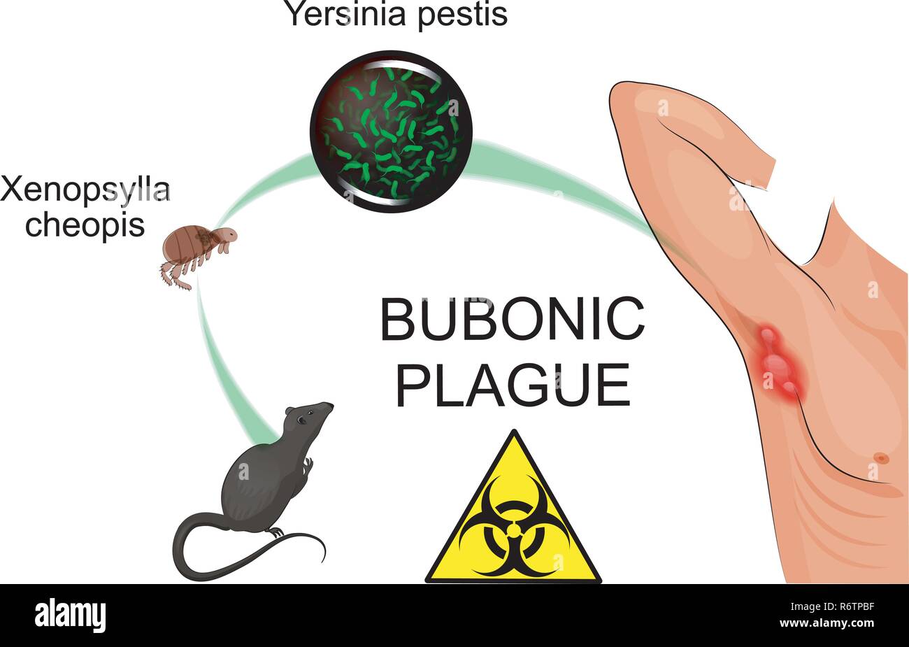 Illustrazione della peste bubbonica patogeno e contagiosa Illustrazione Vettoriale