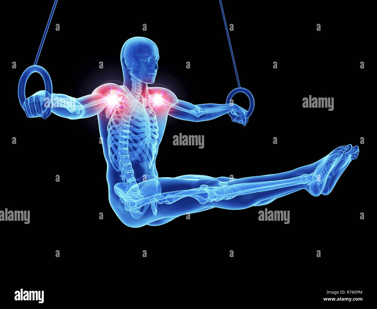 3d reso illustrazione di un atleta spalle dolorose. Foto Stock