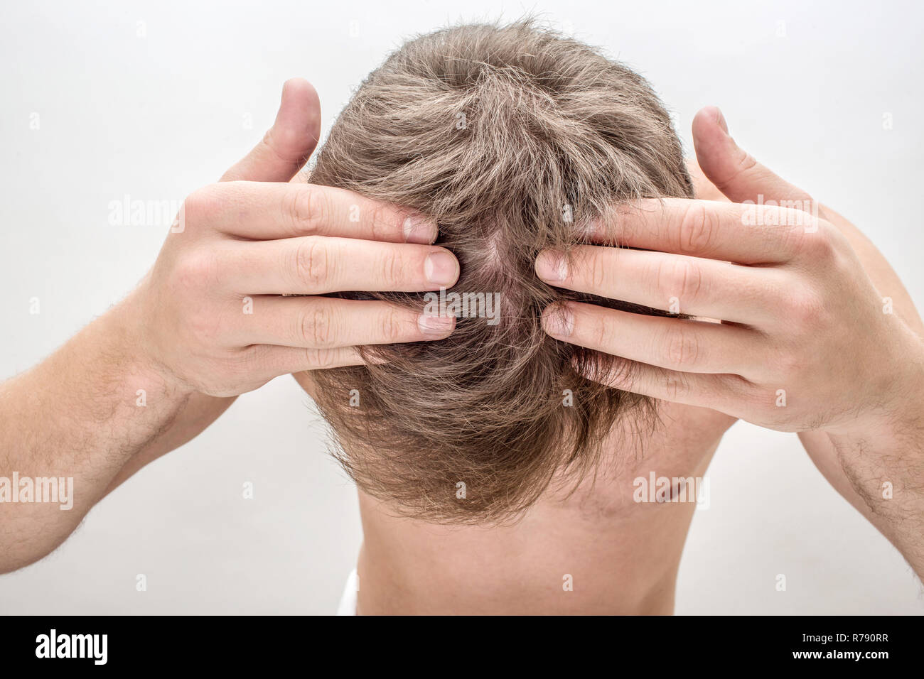 Giovane uomo tenere le mani sui capelli e mostrano spot calvo. Egli ha il problema. Isolato su sfondo bianco. Foto Stock