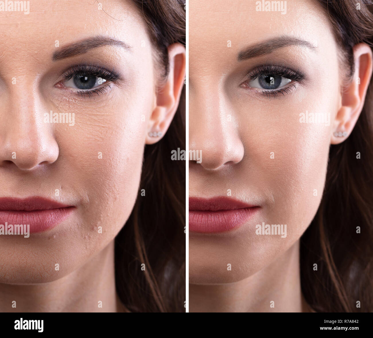 Ritratto di una giovane donna di faccia prima e dopo la procedura di personalizzazione Foto Stock