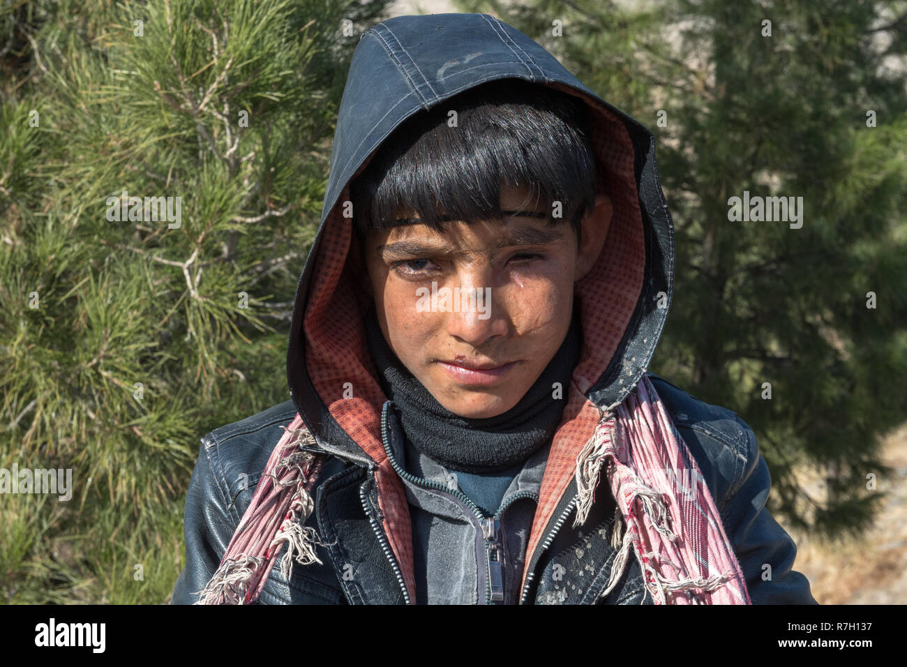 Ragazzo gravemente ferito da una mina antiuomo vende calzini sul ciglio della strada vicino a Museo della Jihad, Herat, provincia di Herat, Afghanistan Foto Stock