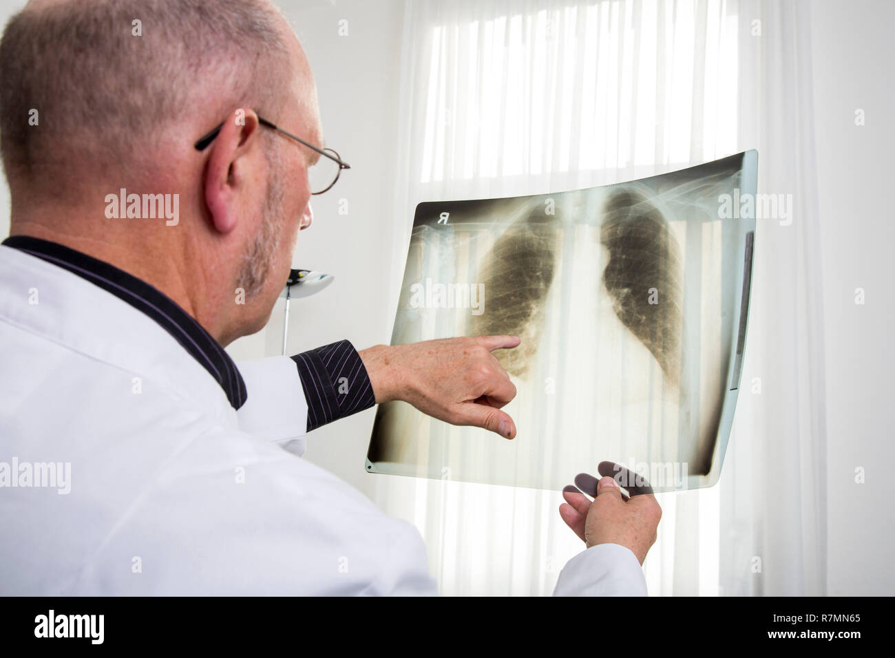 Medico controllo dell'immagine a raggi x di un polmone, Germania Foto Stock