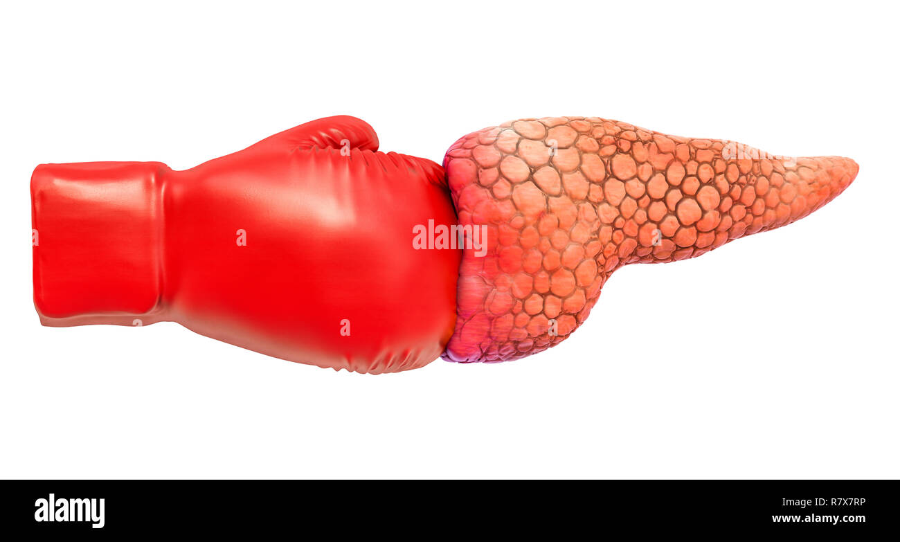Il dolore pancreatico. Il pancreas con guanto di boxe. 3D rendering isolati su sfondo bianco Foto Stock
