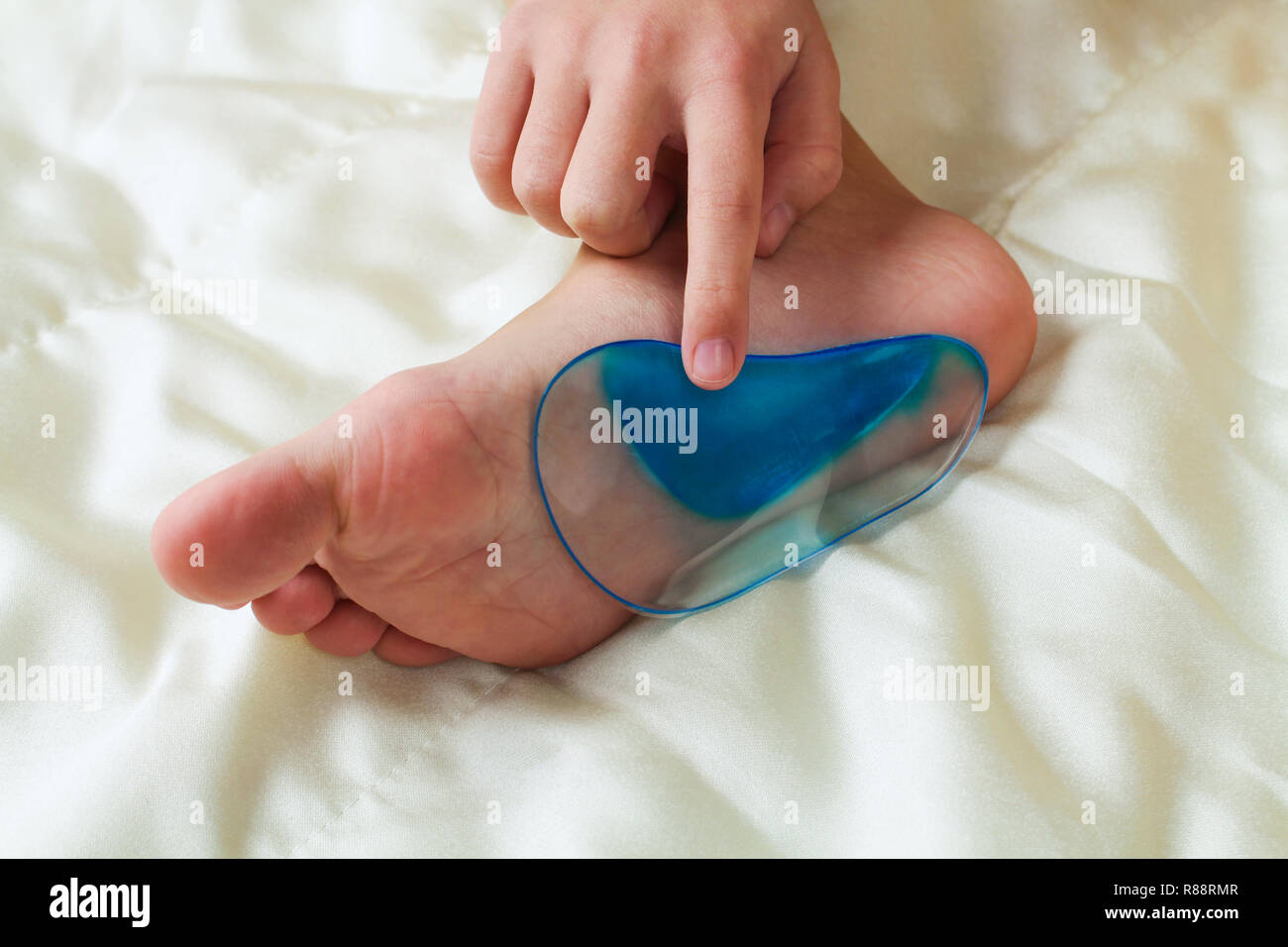 Sottopiedi ortopedici per bambini piedi. Trattamento di flatfoot. Foto Stock