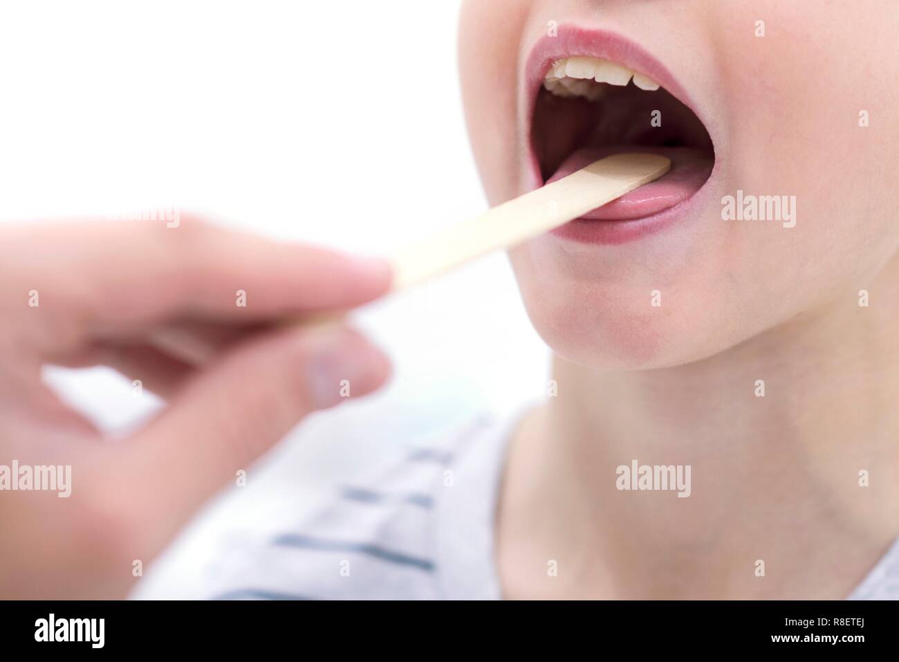 Ragazzo con la bocca aperta e abbassa lingua. Foto Stock