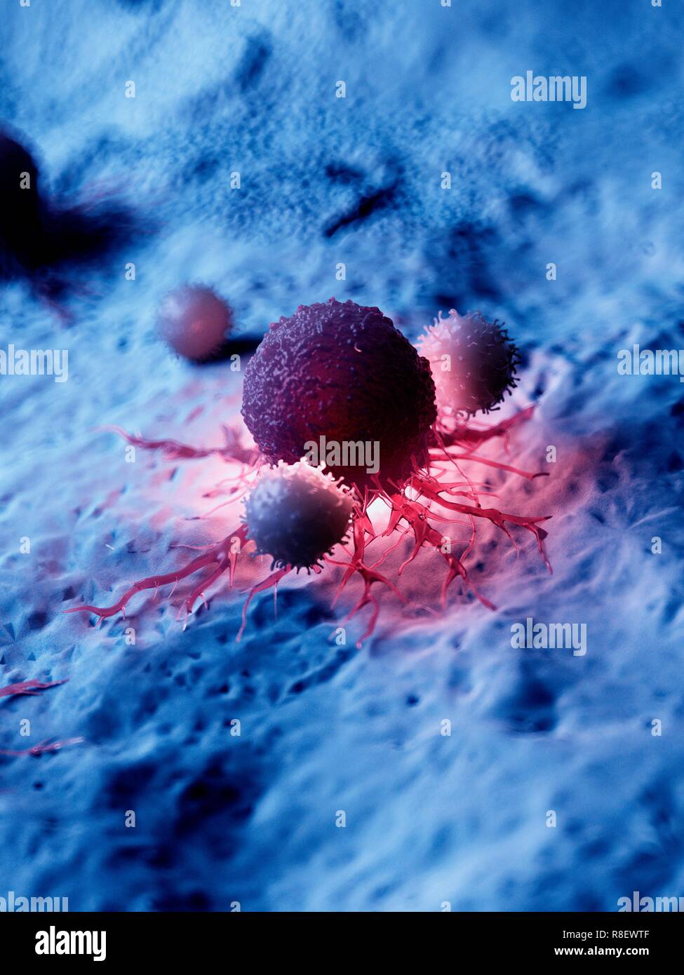 Illustrazione di una cellula di cancro di essere attaccato da cellule bianche del sangue. Foto Stock