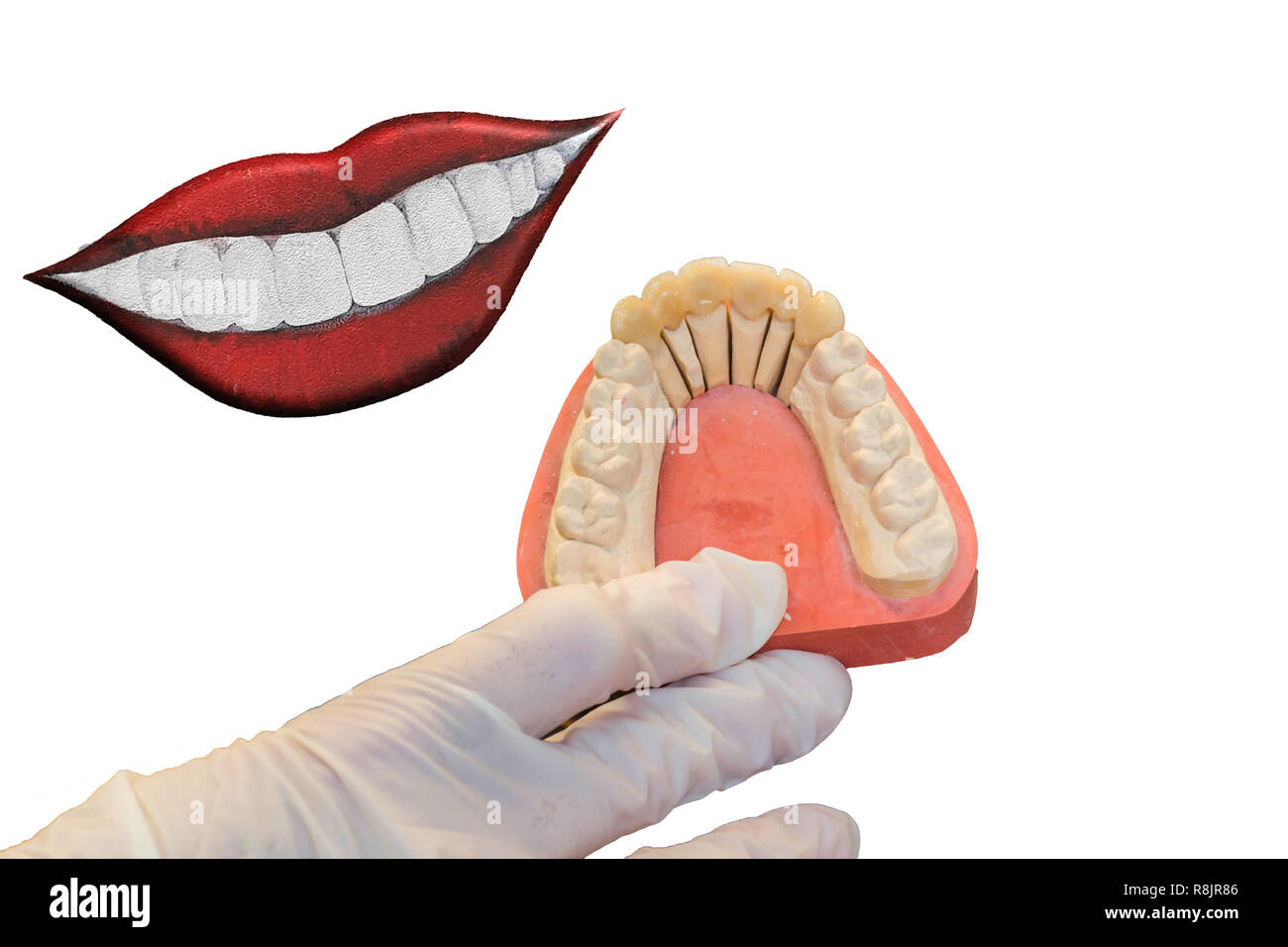 Dentiere, protesi e igiene orale. Le mani con guanti sterili durante la pulizia le dentiere. Foto Stock