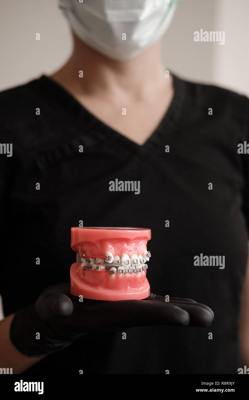 Dentista in guanti neri azienda Dental modello di colata ganasce umana con bretelle in laboratorio protesico. Odontoiatria, ortodonzia. Close up. selective foc Foto Stock