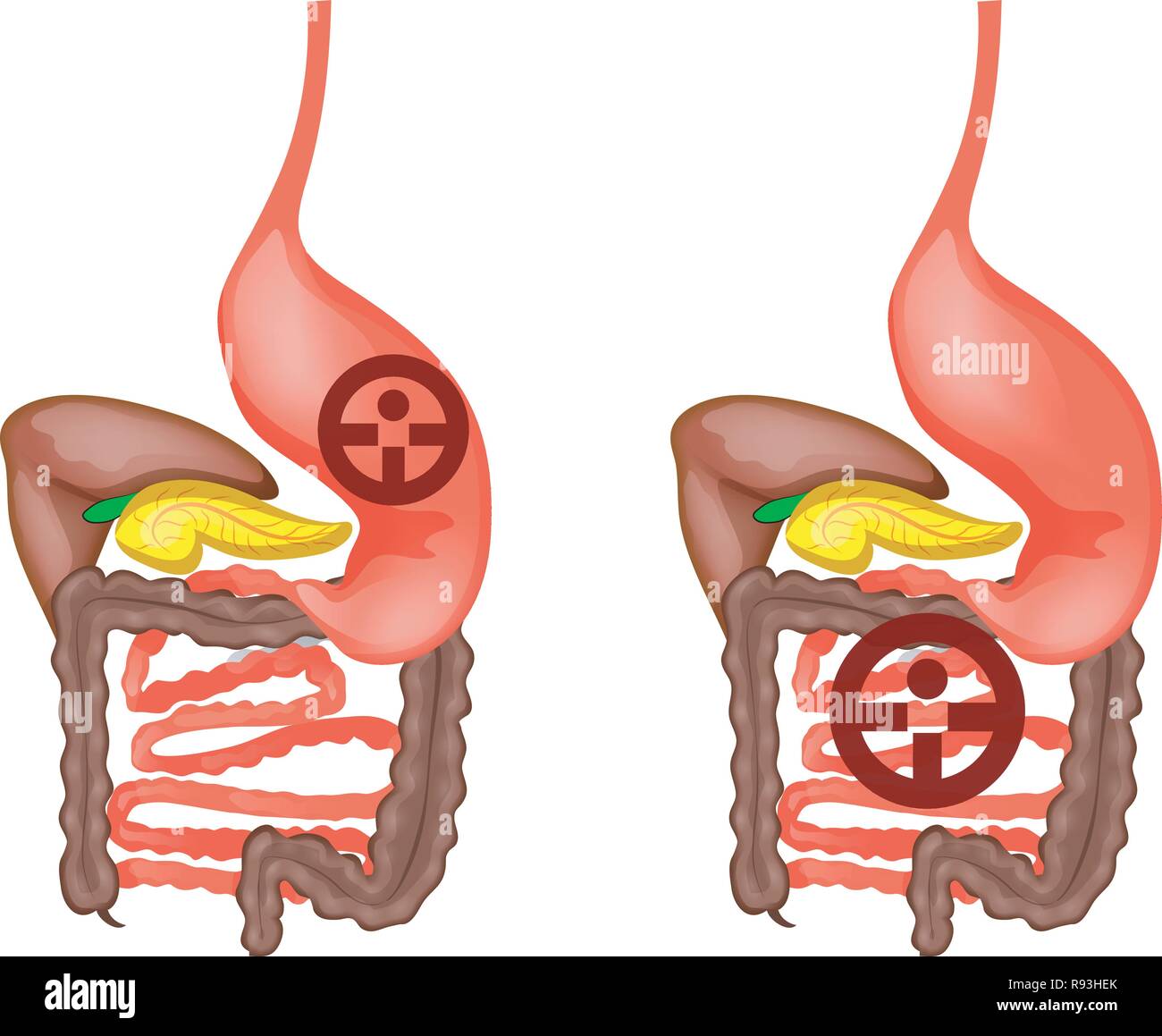 Illustrazione vettoriale del tubo digerente umano Illustrazione Vettoriale