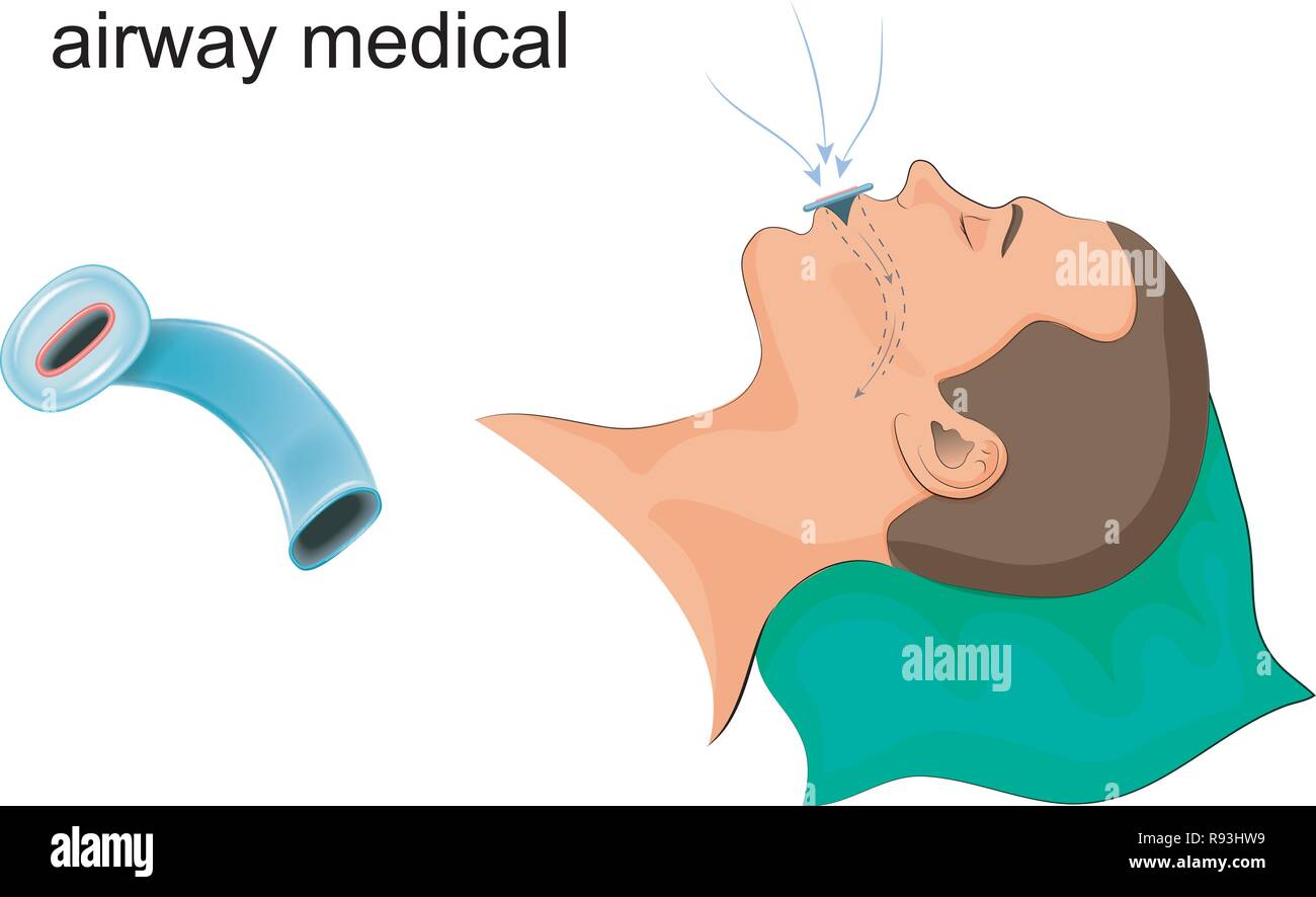 Illustrazione vettoriale di condotto di medici in bocca Illustrazione Vettoriale