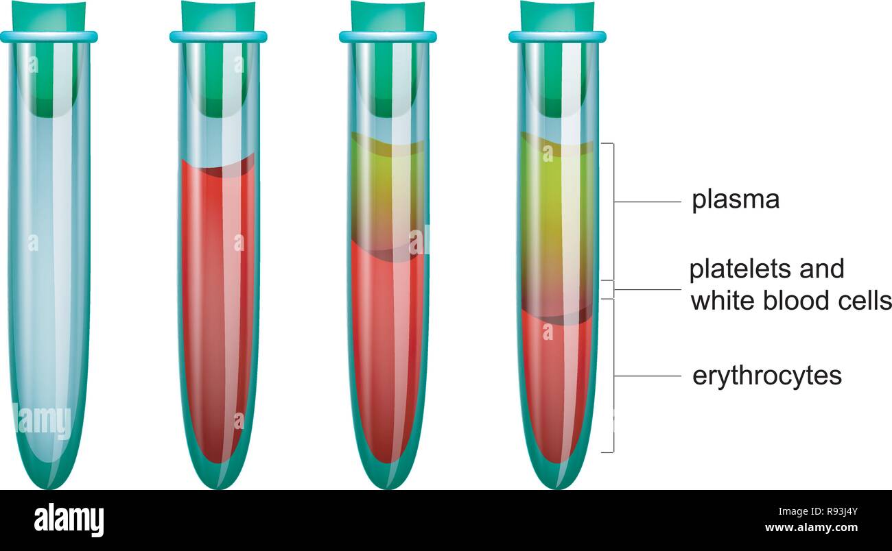 Illustrazione vettoriale del sangue in vitro, il plasma e le cellule rosse del sangue Illustrazione Vettoriale