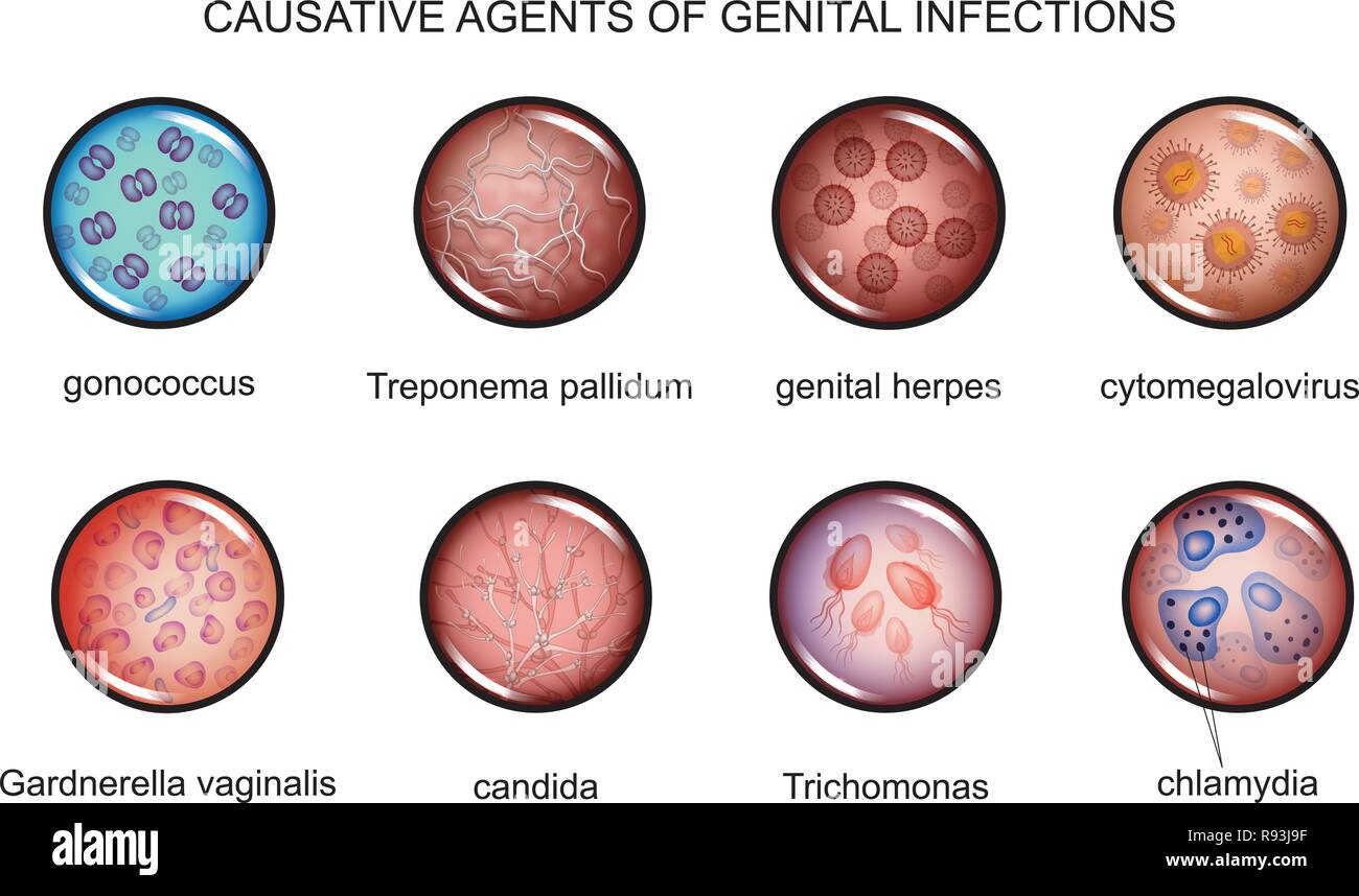 Illustrazione di vettore di agenti patogeni delle infezioni trasmesse sessualmente Illustrazione Vettoriale