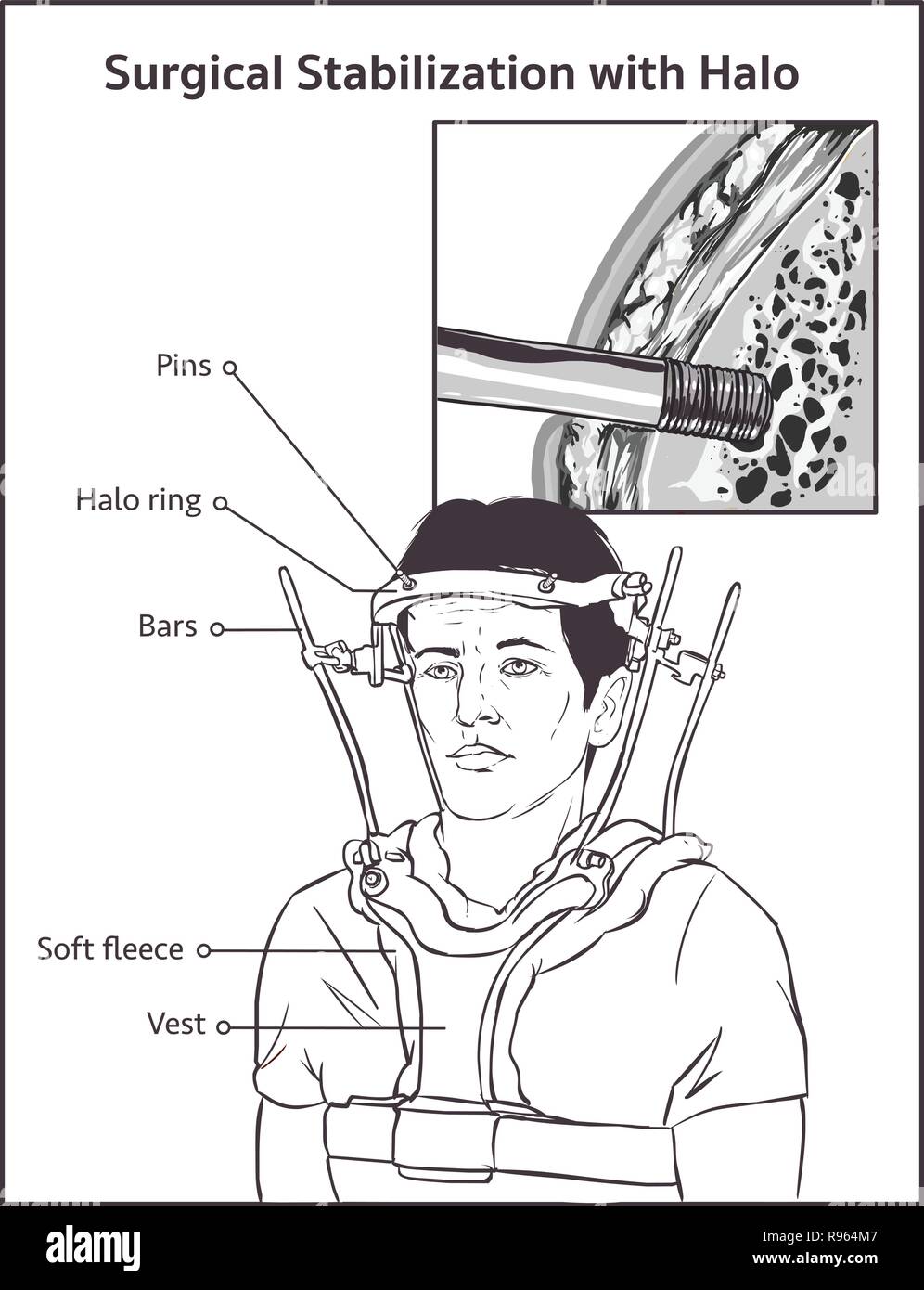 Vista laterale del maschio adulto in Halo vest trazione Illustrazione Vettoriale