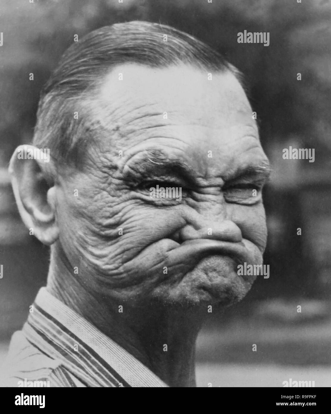 Un uomo con una faccia gommoso e ha un look squishy, ca. 1935. Foto Stock