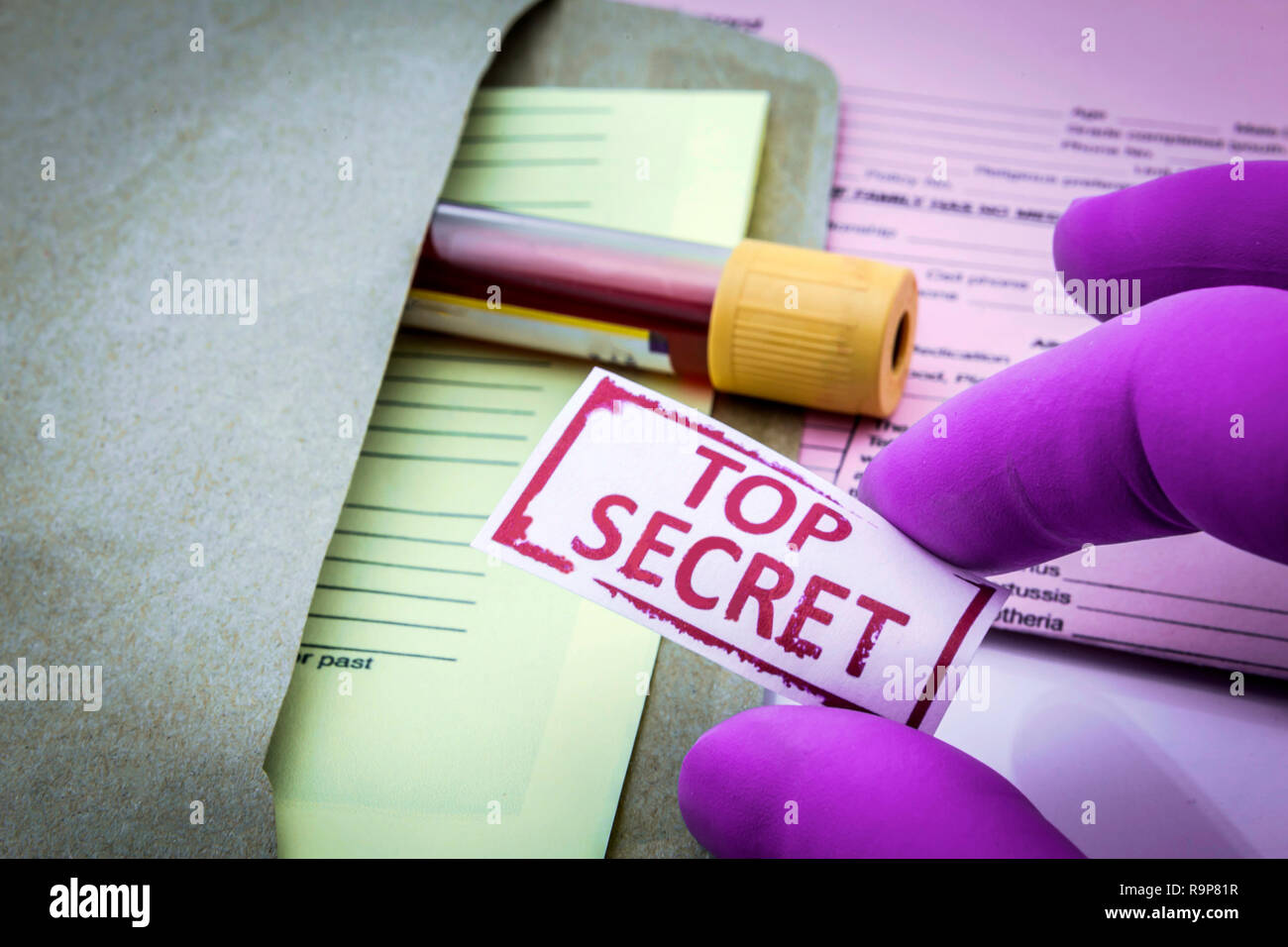 Il Test per la ricerca di sangue, top secret Foto Stock