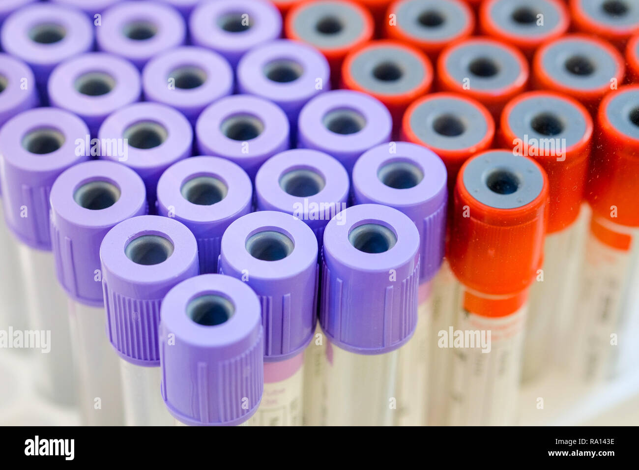 Il gruppo di medici tubo campione, tubo del campione di sangue per in laboratorio per diagnosticare la malattia del paziente è. Foto Stock