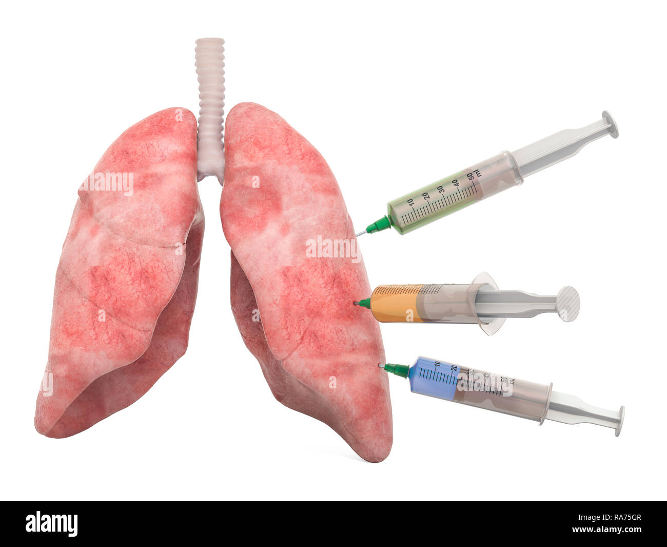 Il trattamento di una malattia polmonare concetto, 3D rendering isolati su sfondo bianco Foto Stock