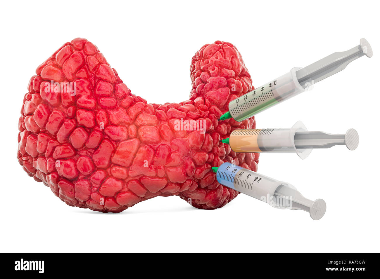 Il trattamento delle malattie della tiroide concetto, 3D rendering isolati su sfondo bianco Foto Stock