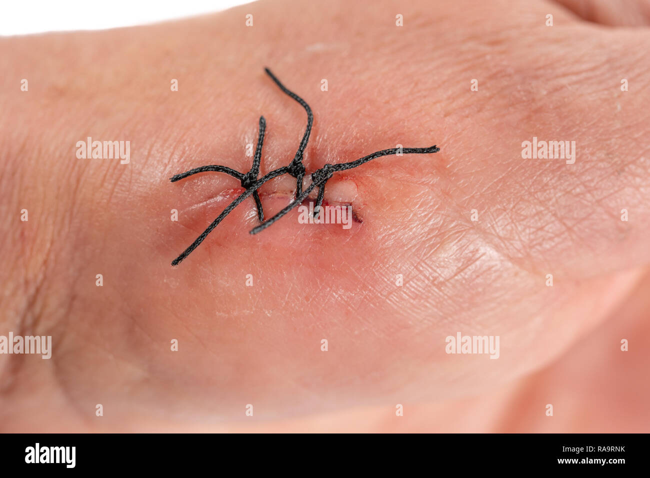 Punto pelle immagini e fotografie stock ad alta risoluzione Alamy