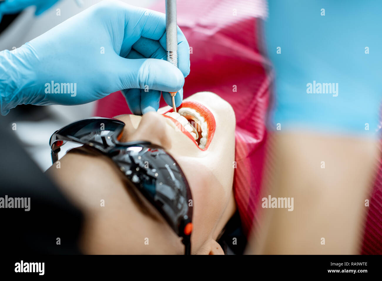 Close-up di un volto di donna durante la professional esame dentale Foto Stock