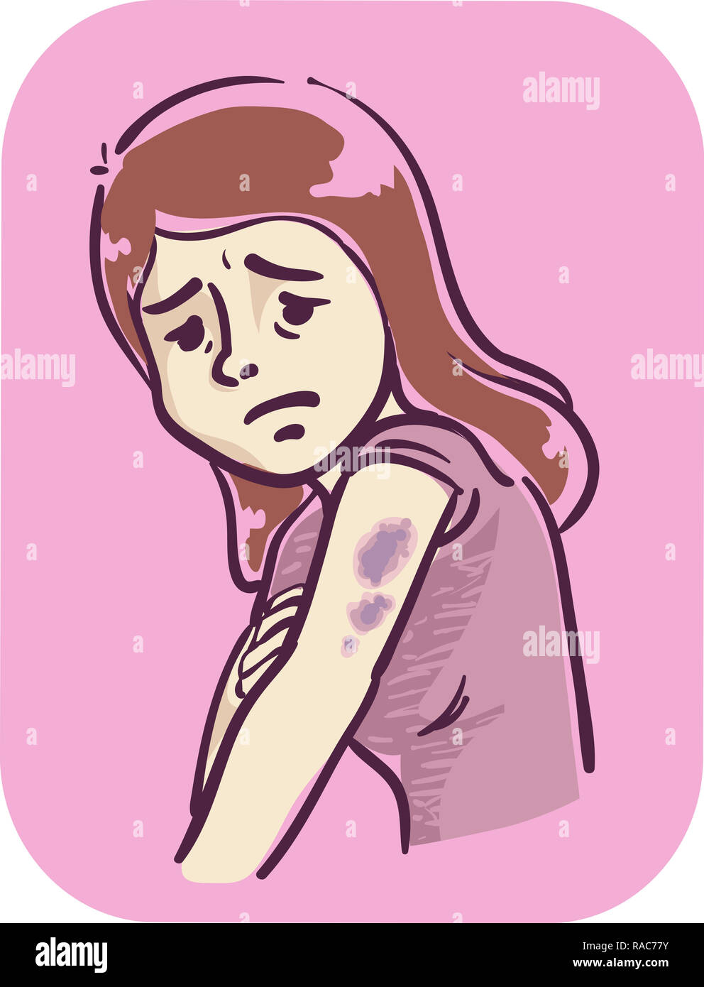 Illustrazione di una ragazza con ammaccature sulle sue braccia Foto Stock