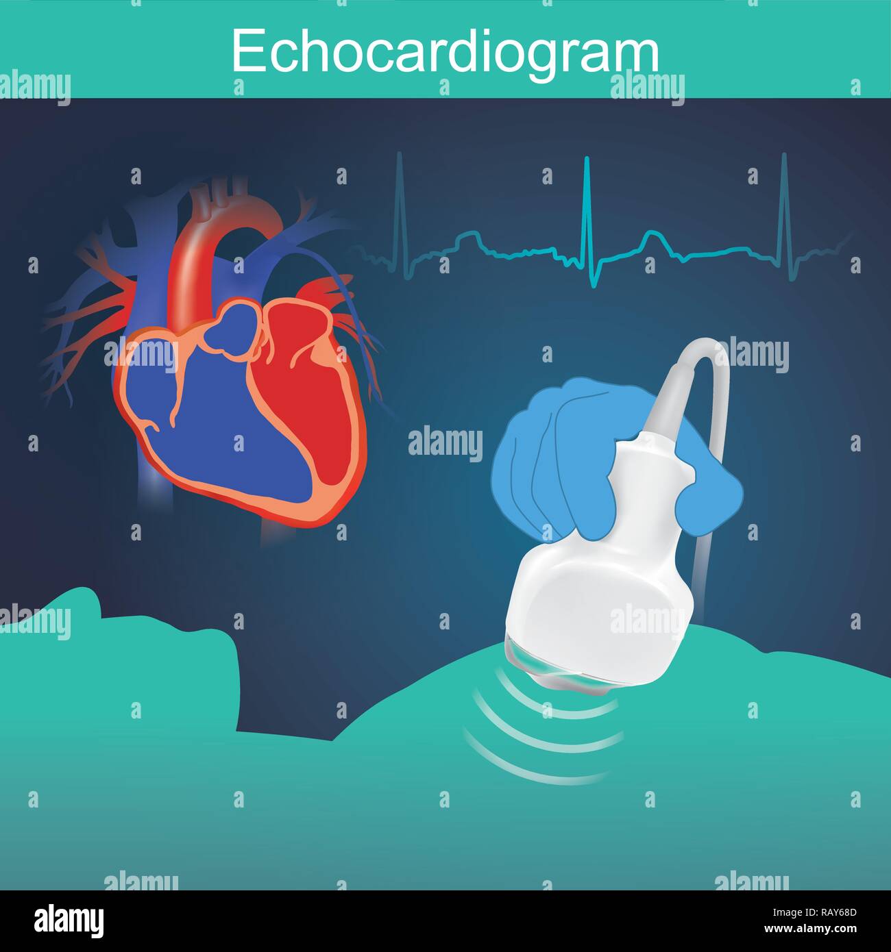 Esame di cuore con suono ad alta frequenza delle forme d'onda molto utile per valutare la funzione del cuore, compresi altri sintomi. Illustrazione Vettoriale