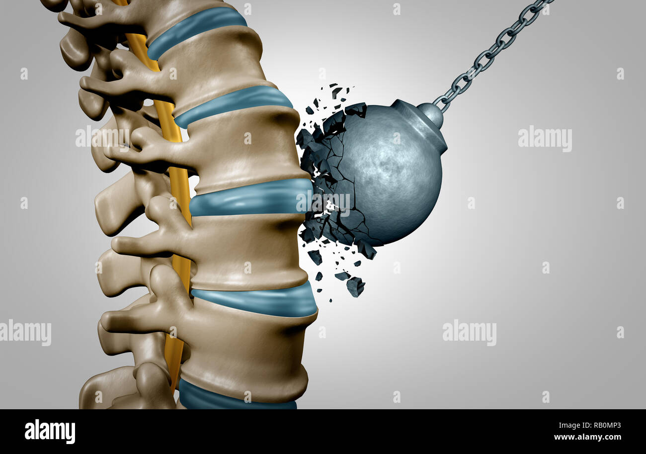 Dorso forte e forza spinale anatomia umana concetto come cure mediche simbolo del corpo con lo scheletro della struttura ossea e dischi intervertebrali. Foto Stock