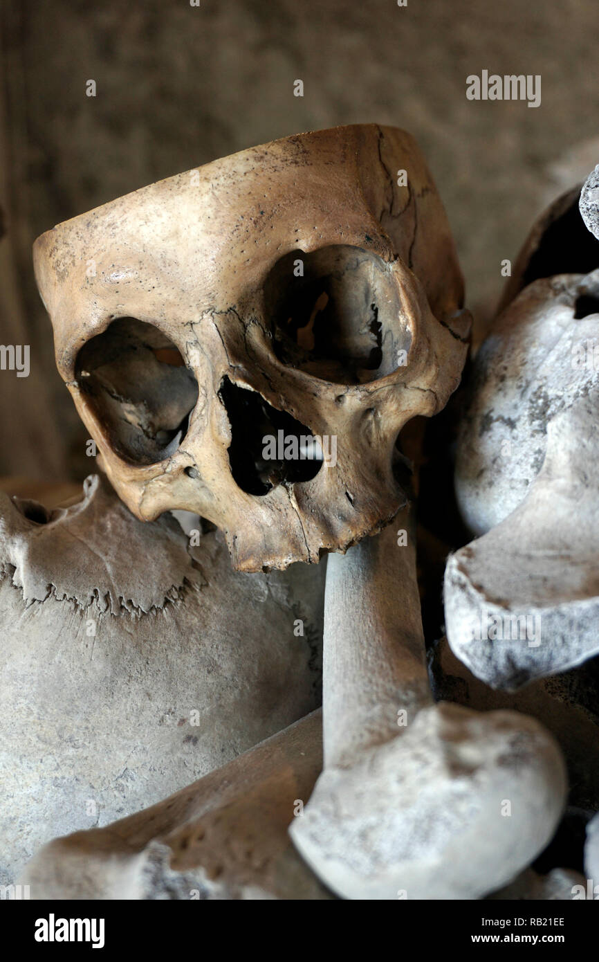Cranio umano con la parte superiore tagliate in appoggio sulla pila di ossa umane Foto Stock