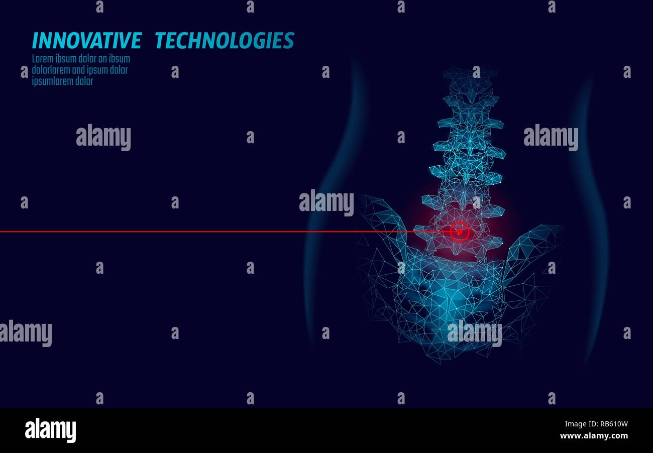 Fisioterapia Laser colonna vertebrale umana. Area di dolore intervento chirurgico medicina moderna tecnologia bassa poli triangoli 3D render femmina ernia posteriore illustrazione vettoriale Illustrazione Vettoriale
