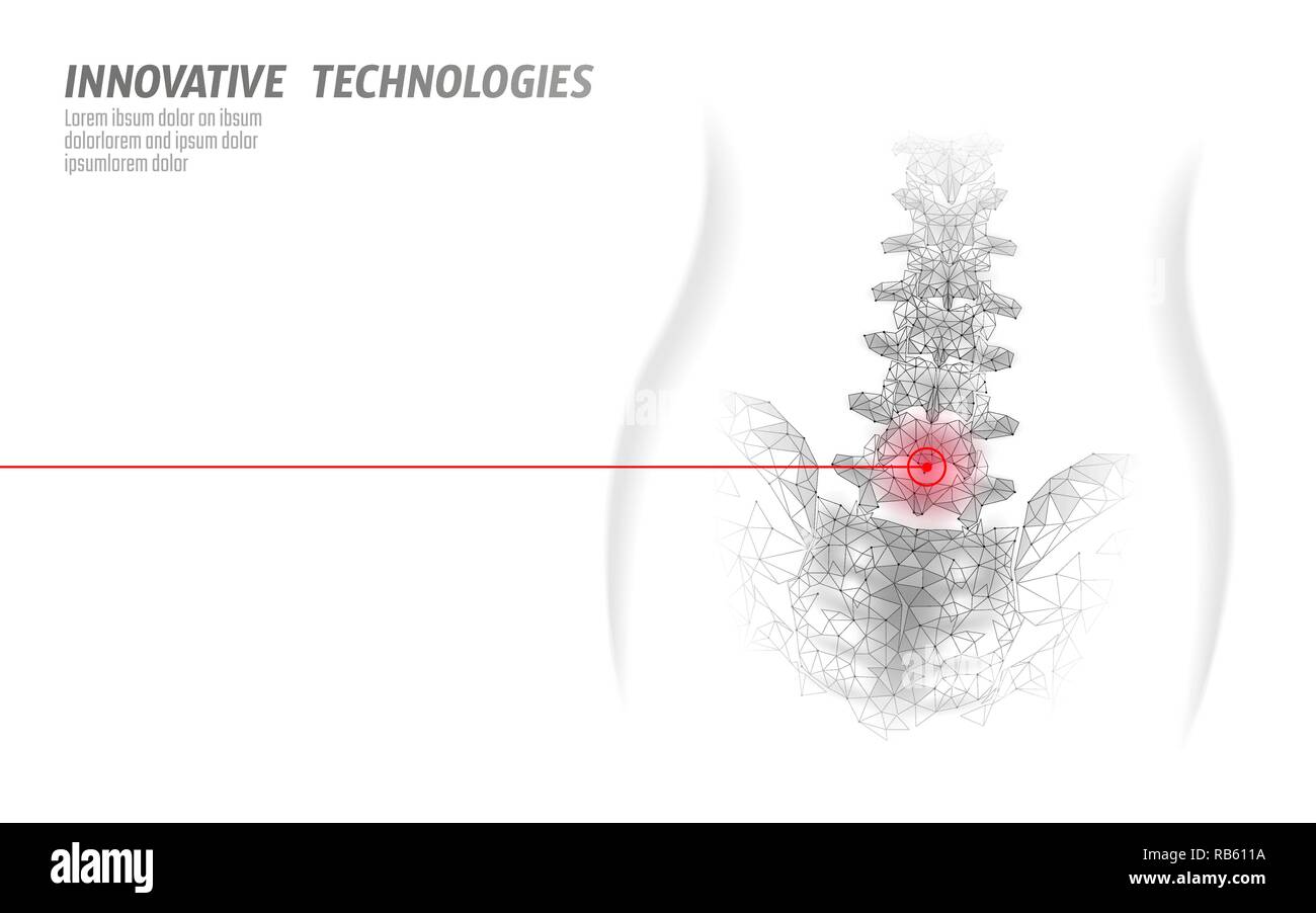 Fisioterapia Laser colonna vertebrale umana. Area di dolore intervento chirurgico medicina moderna tecnologia bassa poli triangoli 3D render femmina ernia posteriore illustrazione vettoriale Illustrazione Vettoriale