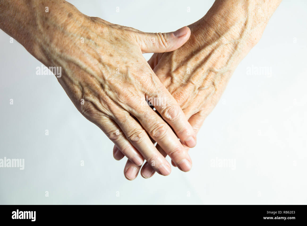 Mani con macchie di vecchiaia Foto stock - Alamy