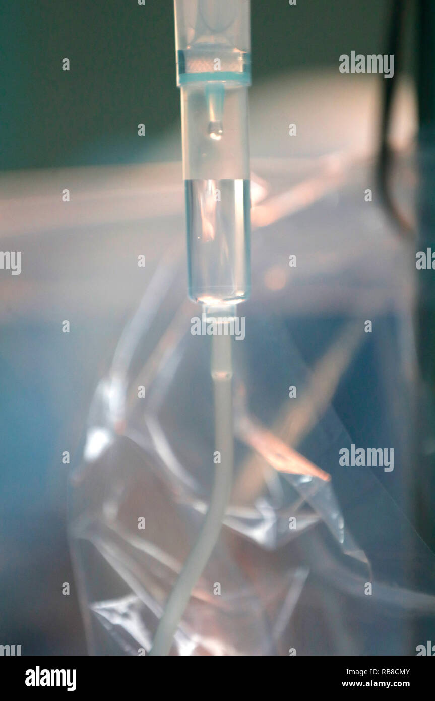 Antigoccia e camera di gocciolamento, close-up. Teatro operativo. Gli interventi di cardiochirurgia. Gocciolamento endovenoso. Close-up. Ho Chi Minh City. Il Vietnam. Foto Stock