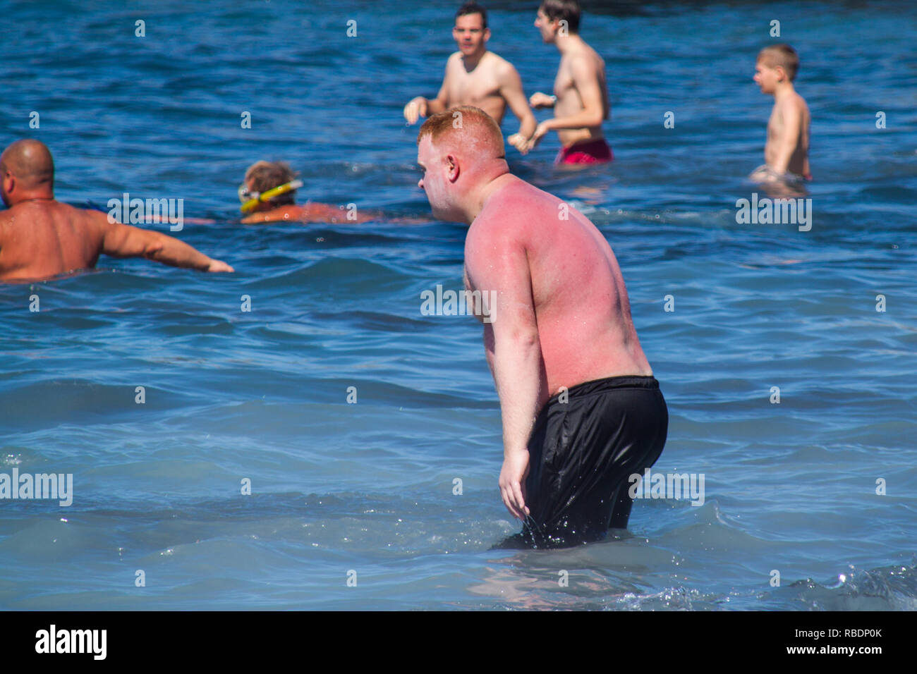 Un uomo bruciata dal sole che sembra come una aragosta è la balneazione in spiaggia Foto Stock